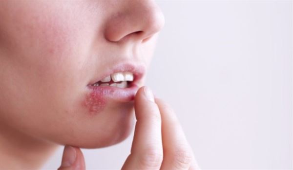 Aucubin có thể giúp làm lành vết thương ở miệng