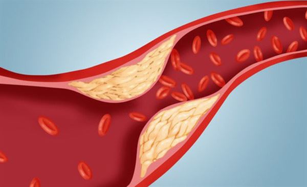 Saponin có tác dụng làm giảm mỡ máu